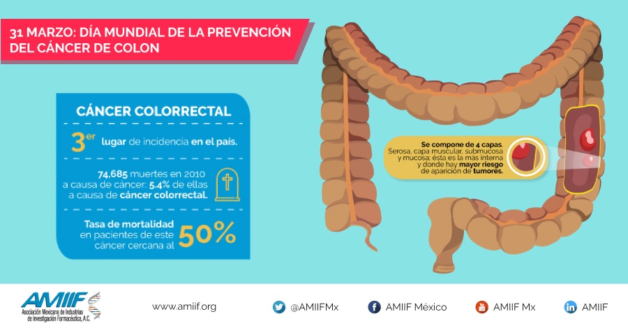 31 de marzo: Día mundial de la prevención del cáncer de colon