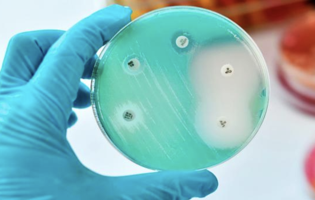 Resistencia antimicrobiana: pandemia silenciosa que amenaza la salud mundial